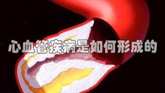 血管超声视频,揭示血管健康奥秘